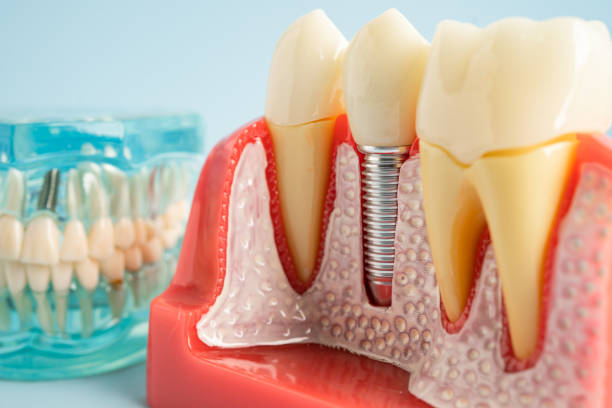 Oral Surgery in Carlisle Rockledge, AL